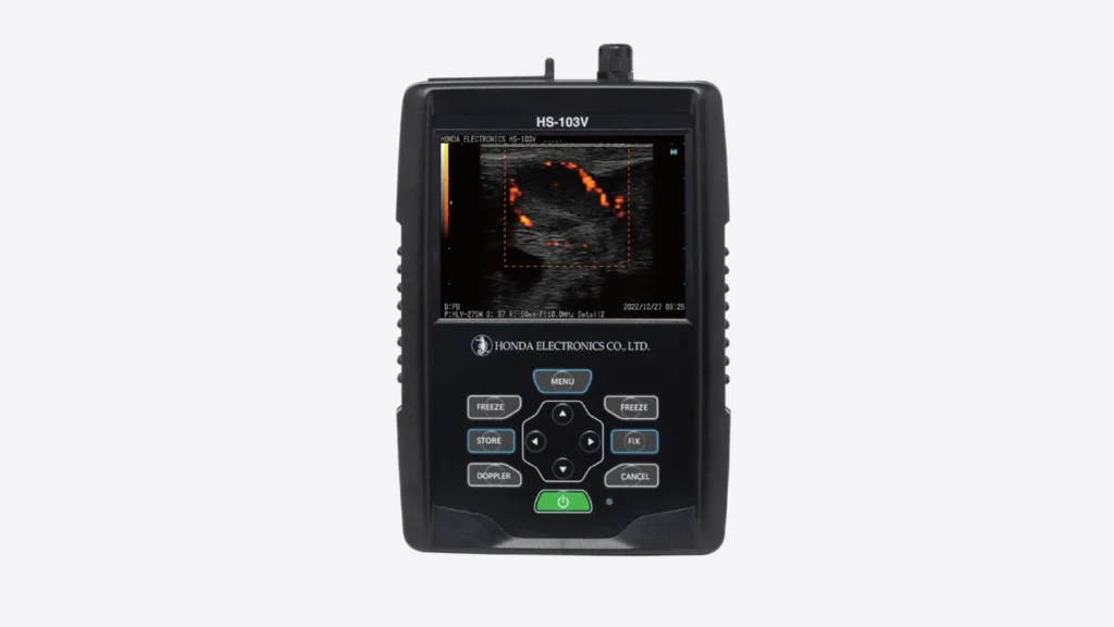 ultrassom hs 103v