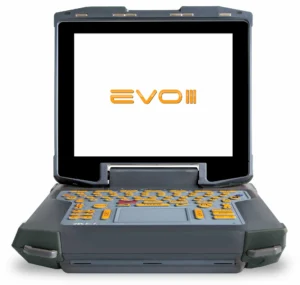 ultrassom ibex evo III